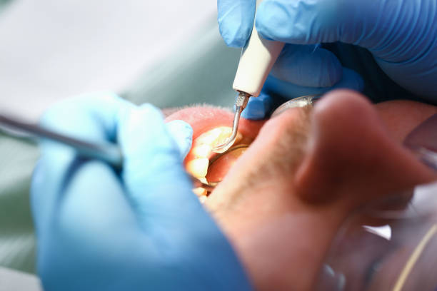 Best Same-Day Emergency Dentist in Ferrum, VA